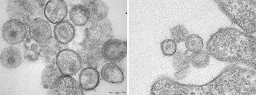 Cells without the Human Schlafen 11 gene have more HIV virus-like particles (seen as round dots at left) than cells at right that express the gene. Credit: Manqing Li, UC San Diego