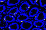 Gut cells identified by their nuclei (blue) making ISG15 (yellow), an important anti-viral and pro-inflammatory factor. Gut cells identified by their nuclei (blue) making ISG15 (yellow), an important anti-viral and pro-inflammatory factor.
