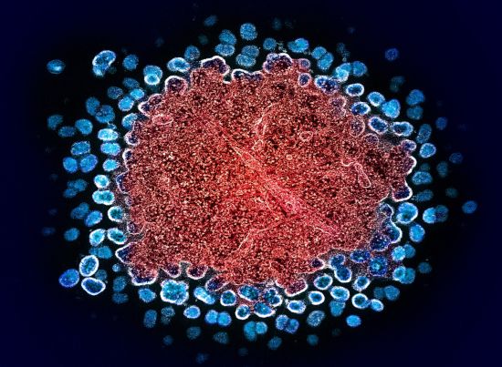 Numerous HIV-1 virus particles replicate from a segment of an H9 T cell, a step in HIV infection supported by the RNA chemical modifications described in the study. Image: NIAID