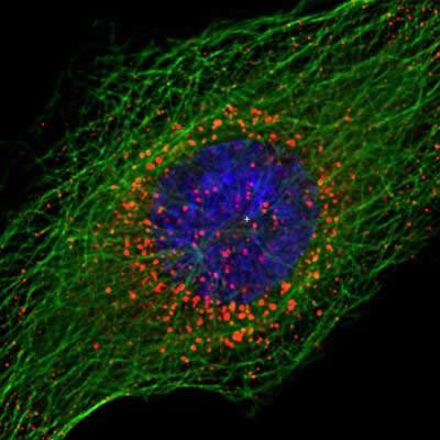 IMAGE: HIV Outside Cell Nucleus