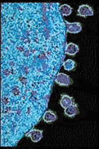  New HIV particles exiting an infected T-cell - Photo: National Institutes of Health 