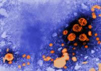 IMAGE: These are hepatitis B particles as viewed under an electron microscope.