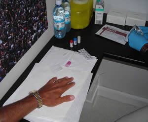 Photo: Bradford McIntyre, Volunteer, receives bioLytical Laboratories Inc. INSTIT Kit HIV Diagnosis in 60 seconds. bioLytical Laboratories HIV/AIDS Mobile Testing campaign Test Your Commitment.