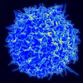 Scanning electron micrograph of a human T cell from the immune system of a healthy donor. In multiple sclerosis, certain kinds of T cells are involved in the immune systems attack on the central nervous system. NIAID