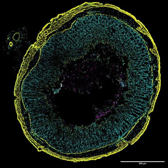 ImAGE: A new imaging approach used microscopic glowing tags to reveal gene activity in individual C. diff cells in gut tissue samples from infected mice. Image: Nicholas DiBenedetto, CC by NonCommercial-NoDerivatives 4.0 International Clostridioides difficile