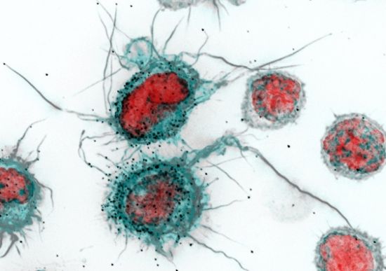 An HIV micrograph. Image: Kirby Institute at UNSW Sydney An HIV micrograph. Image: Kirby Institute at UNSW Sydney