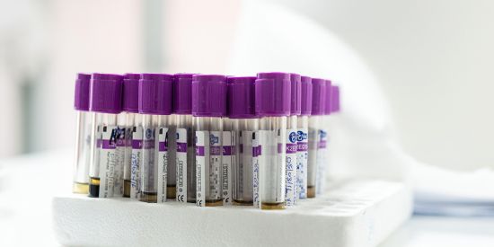 Blood samples from patients for viral load and HIV resistance testing. (Photo: Christian Heuss, SolidarMed) Blood samples from patients for viral load and HIV resistance testing. (Photo: Christian Heuss, SolidarMed)