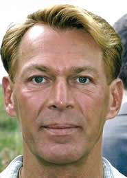 Photo: Bradford McIntyre, volunteer patient, after receiving Bio-alcamid treatment for lipoatrophy (facial wasting), 2004. Photo Credit: Jacqueline Turpin