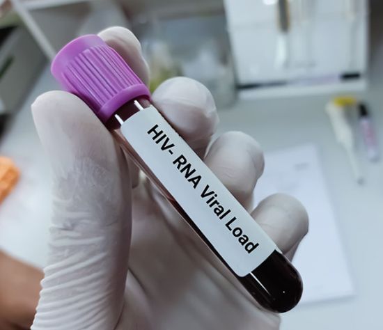 HIV blood vial in lab