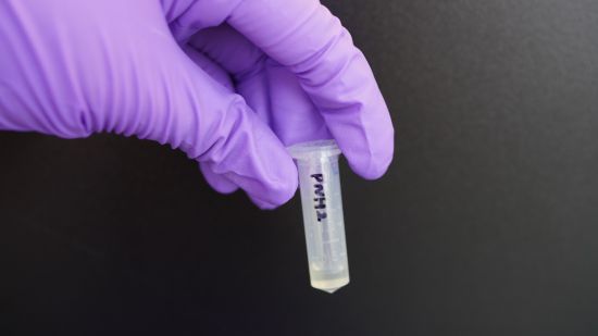 COE-PNH2 (in the vial), a new antibiotic developed by researchers from the NUS Institute for Functional Intelligent Materials, eradicates the bacteria thoroughly, eliminating any potential grounds for resistance while reducing the likelihood of relapse. COE-PNH2 (in the vial), a new antibiotic developed by researchers from the NUS Institute for Functional Intelligent Materials, eradicates the bacteria thoroughly, eliminating any potential grounds for resistance while reducing the likelihood of relapse.