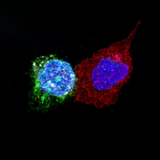 CD8+ T cells of an HIV controller in contact with HIV-infected CD4+ T cells. CD8+ T cells (red) of a controller in contact with HIV-infected CD4+ T cells (viral protein gp120 stained green). The cell nuclei are in blue. The cytotoxic molecule granzyme B is shown in pink.Confocal microscopy. © Institut Pasteur/Anastassia Mikhailova
