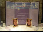 Face Forward Foundation Exhibit Photos of Bradford McIntyre, living with HIV: Before & After Facial Reconstruction for facial lipoatrophy in 2004, at the 16th Annual Canadian Conference on HIV/AIDS Research - April 26 - 29, 2007, Toronto, Canada.