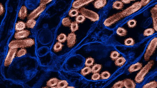Colorized micrograph of avian influenza A H5N1 virus particles (in pink). This flu is widespread in wild birds worldwide and causing outbreaks in poultry and U.S. dairy cows. To date, 45 human cases have been reported. Image: CDC, NIAID