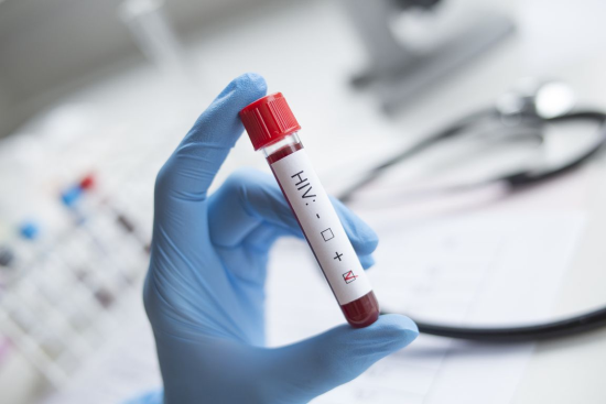 Gloved hand holding vial of blood marked HIV