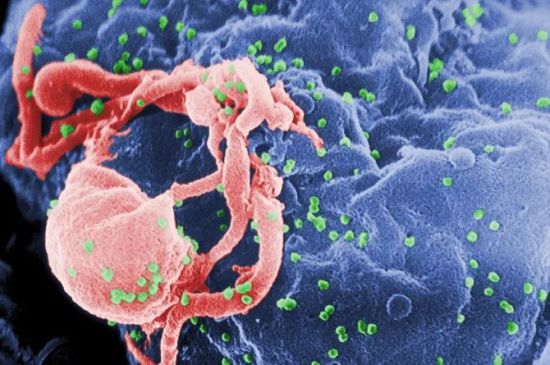 HIV (in green) on an immune cell (Photo: CDC/Public Domain)