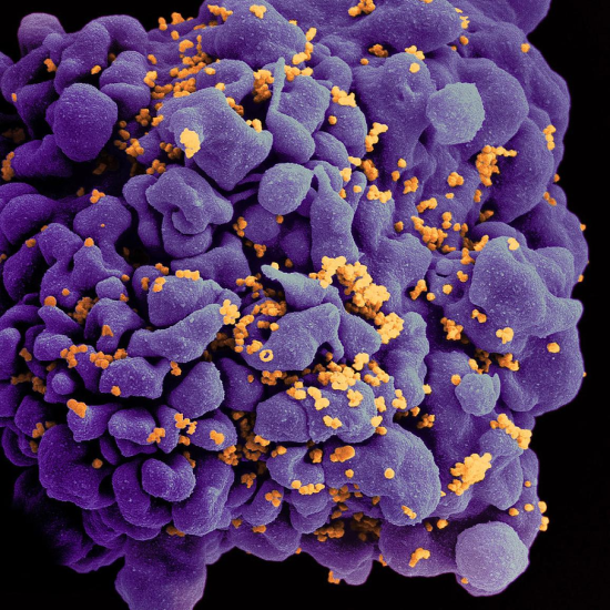 Scanning electron micrograph of an HIV-infected H9 T cell, colorized in Halloween colors.