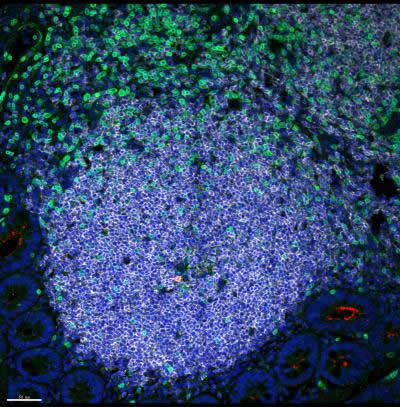 HIV disrupts the lymphoid immune battleground