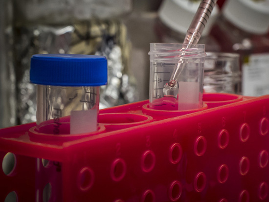 Researchers hope to learn whether the immune system will respond to the experimental vaccines by making antibodies and T cells that could fight HIV if a person is ever exposed to the virus in the future.
