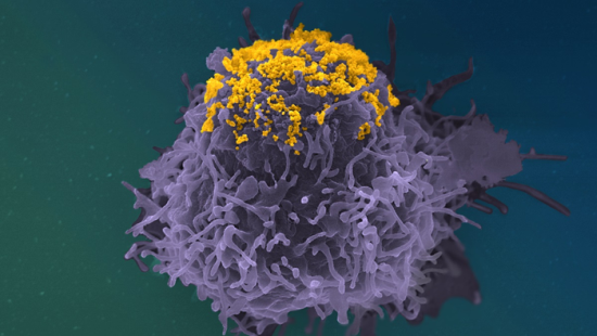 HIV particles (in yellow) accumulating on the surface of an infected cell (in purple)