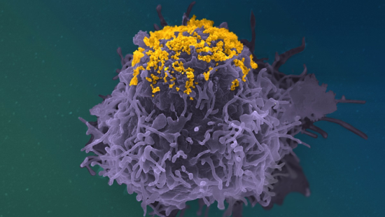 HIV particles (in yellow) accumulating on the surface of an infected cell (in purple). CREDIT: © Stéphane Fremont, Jérémy Dufloo, Arnaud Echard, Timothée Bruel, Olivier Schwartz, Jean-Marc Panaud, Institut Pasteur HIV particles (in yellow) accumulating on the surface of an infected cell (in purple)
