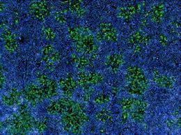 Human cells infected with MPXV (in green) among uninfected cells (nuclei in blue). Image taken with a confocal microscope.  Mathieu Hubert and Olivier Schwartz, Institut Pasteur.