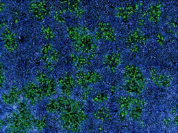 Human cells infected with MPXV (in green) among uninfected cells (nuclei in blue). Image taken with a confocal microscope.  Mathieu Hubert and Olivier Schwartz, Institut Pasteur.
