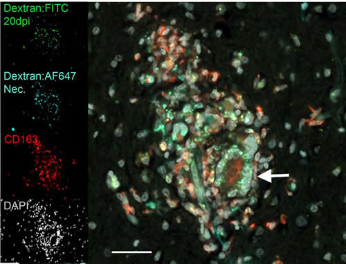  Dyes illuminate macrophage and monocyte cells as they arrive in the brain