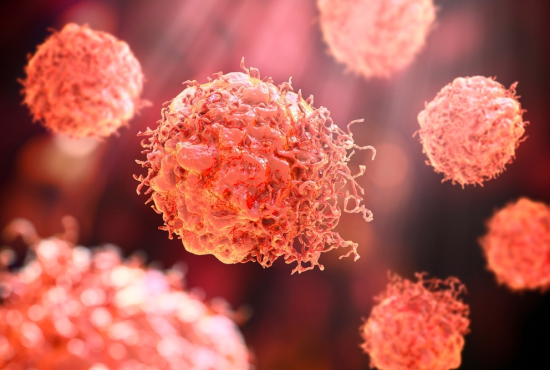 Illustration of malignant cancer cells.
