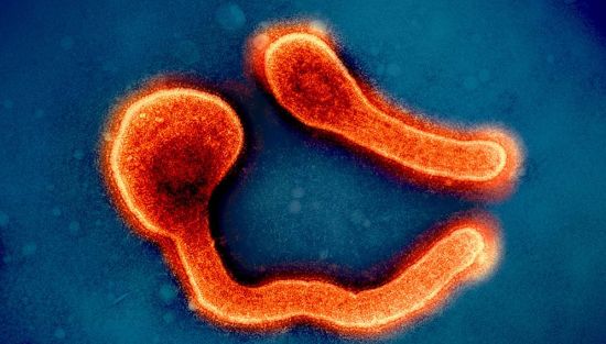 Image: Colourised transmission electron micrograph of two Marburg virus particles (orange). Tanzania has declared an outbreak of the virus. Copyright: NIAID (CC BY 2.0). Colourised transmission electron micrograph of two Marburg virus particles (orange). Tanzania has declared an outbreak of the virus. Copyright: NIAID (CC BY 2.0).