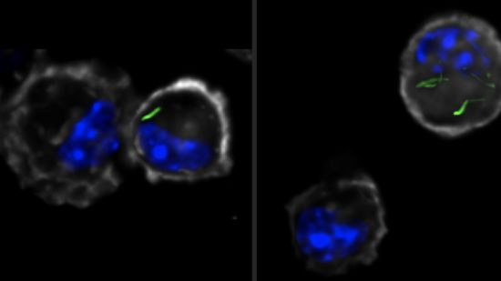 Mycobacterium tuberculosis-infected alveolar macrophages at day 10 after infection. Mtb in green. Mycobacterium tuberculosis-infected alveolar macrophages at day 10 after infection. Mtb in green.