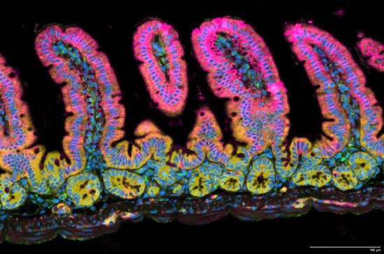Image: An image produced through Xenium analysis of mouse small intestines. Protruding “villi” stick up from the lining of the small intestine. Valley-like “crypts” fill in the gaps. Credit: Image from the Reina Lab, La Jolla Institute for Immunology An image produced through Xenium analysis of mouse small intestines. Protruding “villi” stick up from the lining of the small intestine. Valley-like “crypts” fill in the gaps. Credit: Image from the Reina Lab, La Jolla Institute for Immunology