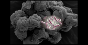 Image of salmonella bacteria set against an illustration of the 3D model of human tissue