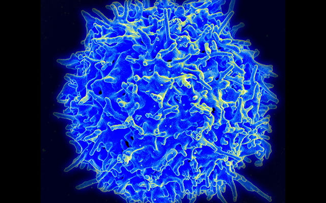 T cell - Photo credit: NIAID