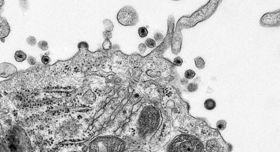 aids in process hiv infection of human lymphoid cd4 t cells aids in process hiv infection of human lymphoid cd4 t cells