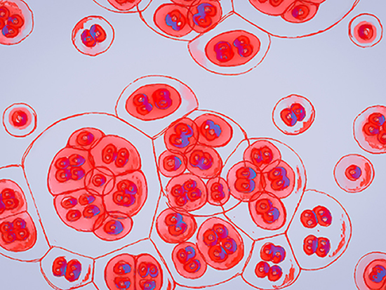Image: virus cells