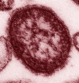 CDC / Cynthia S. Goldsmith, William Bellini