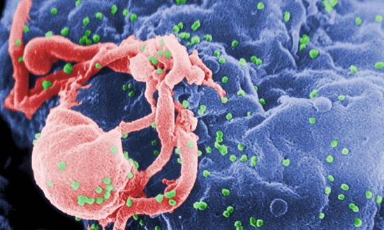 Scanning electron micrograph of HIV-1 budding (in green) from cultured lymphocyte