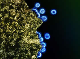 Image of a blue HIV virus particle emerging from a yellow, globular-shaped H9 T cell
