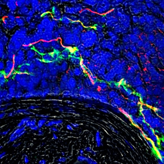 Image: Caption: Nerve bundles in the diseased artery external layer (adventitia) visualised as red, fluorescent filaments. Growing new nerve bundles are visualised as green, fluorescent filaments. Image credit: Dr Sarajo Kumar Mohanta Growing Nerve bundles