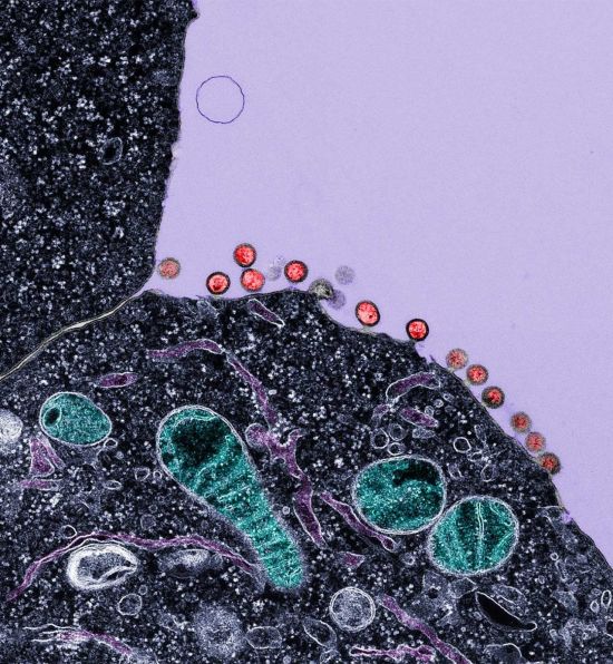 Cells infected with HIV, demonstrating budding of the virus (red) from the plasma membrane. The green labels mitochondria and the dark purple labels intracellular membranes. The black labels the cell cytoplasm. Image by Gladstone Institutes