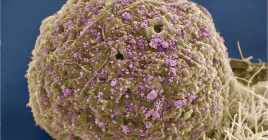 A colorized scanning electron micrograph depicts HIV particles (purple spheres) infecting a cell in the immune system. Mark Ellisman and Tom Deerinck, NCMIR, UC San Diego