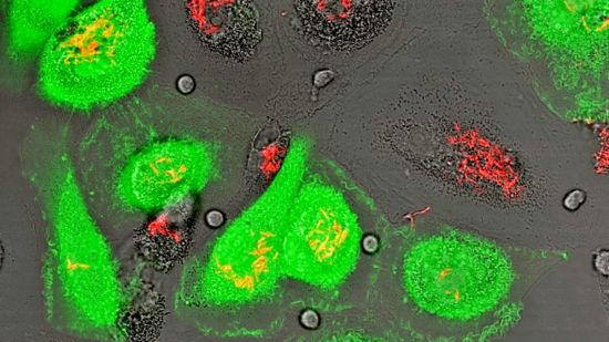 Bright green microscope of HIV TB