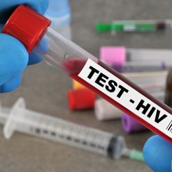 TEST - HIV