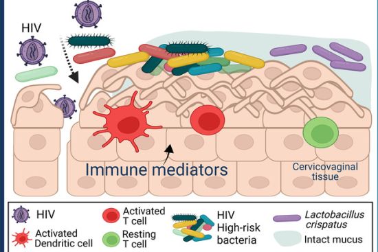 Image: In the presence of certain bacterial vaginosis-associated bacteria, the mucosal barrier breaks down and immune cells are activated and become more susceptible to HIV infection (in red). Dr. Sujatha Srinivasan and colleagues identified 14 bacteria groups and six inflammatory proteins associated with high risk of HIV infection in women with bacterial vaginosis.
Adapted from Srinivasan, S. et al., J Infectious Diseases, 2024 In the presence of certain bacterial vaginosis-associated bacteria, the mucosal barrier breaks down and immune cells are activated and become more susceptible to HIV infection (in red). Dr. Sujatha Srinivasan and colleagues identified 14 bacteria groups and six inflammatory proteins associated with high risk of HIV infection in women with bacterial vaginosis.
Adapted from Srinivasan, S. et al., J Infectious Diseases, 2024