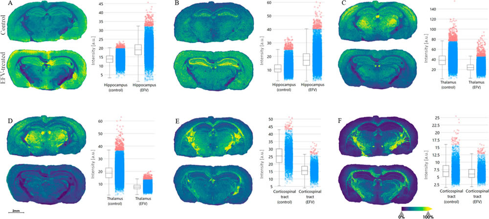 These images show the lipid distribution in tissue samples treated with the HIV drug Efavirenz (lower image in each pairing) and untreated samples. The charts accompanying each pair of images quantify the different in expression of a particular lipid between the treated and untreated samples. (ACS Pharmacol. Transl. Sci. 2024, 7, 8, 2379-2390) These images show the lipid distribution in tissue samples treated with the HIV drug Efavirenz (lower image in each pairing) and untreated samples. The charts accompanying each pair of images quantify the different in expression of a particular lipid between the treated and untreated samples. (ACS Pharmacol. Transl. Sci. 2024, 7, 8, 2379-2390)