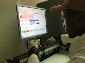A lab technician in Lesotho prepares blood samples to measure viral load. (Photo: Niklaus Labhardt, SolidarMed)