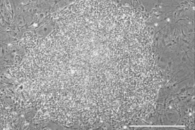 Monkey iPSCs with edited CCR5 locus growing in culture