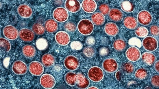 Image: A microscopic image of mpox virus particles. Photo courtesy of the CDC/National Institute of Allergy and Infectious Diseases (NIAID). A microscopic image of mpox virus particles. Photo courtesy of the CDC/National Institute of Allergy and Infectious Diseases (NIAID).