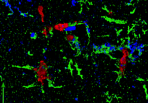 SIV infection (red) in microglia cells (green) in the brain