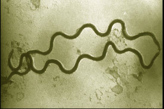 Syphilis Syphilis